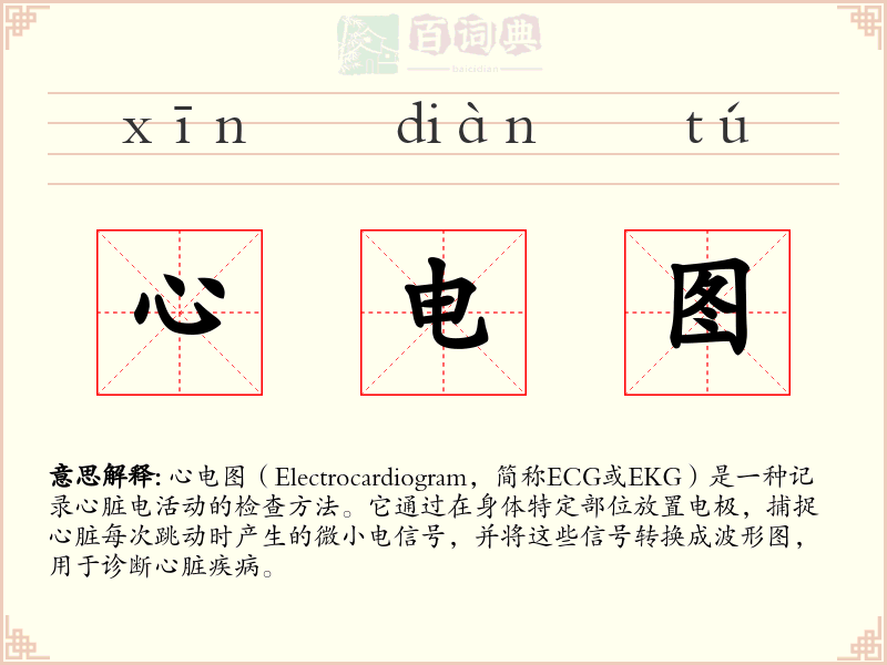 心电图