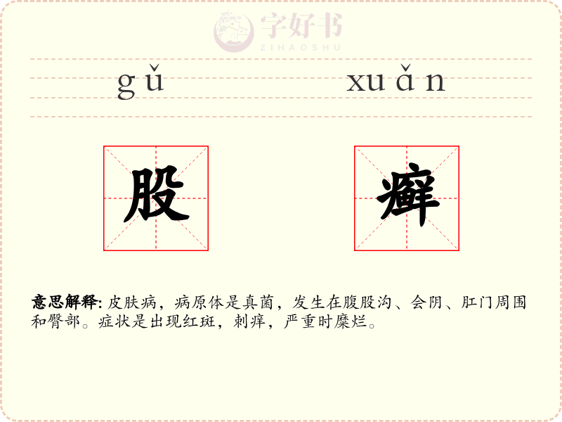 股癣
