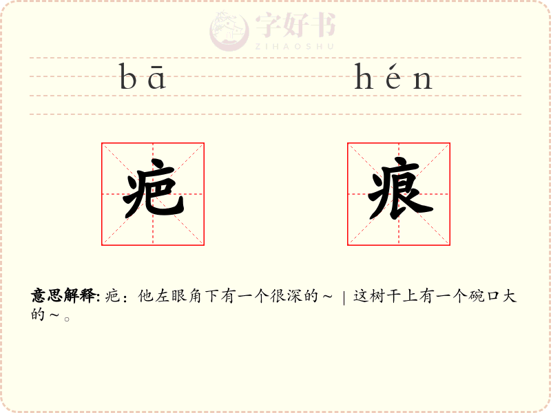 疤痕