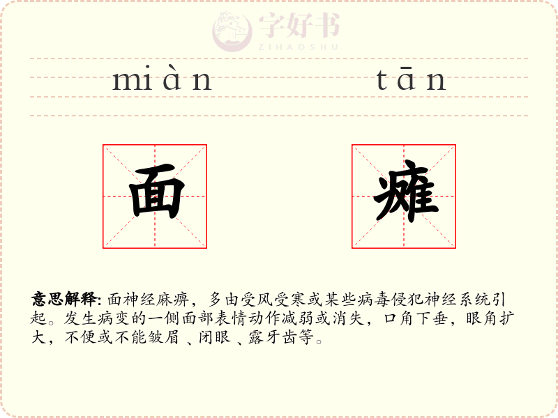 面瘫